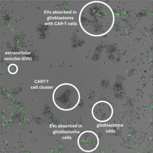 Glioblastoma, extracellular vesicles and CAR T-cells